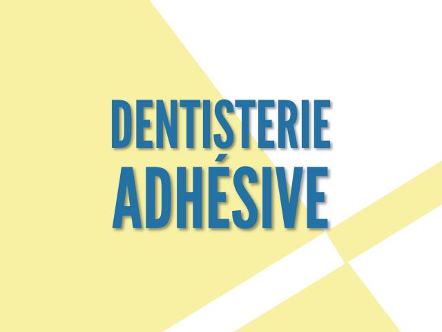 LA DENTISTERIE ADHESIVE INDIRECTE
