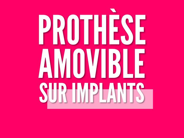 PROTHESES AMOVIBLES ET IMPLANTS : UNE ASSOCIATION UTILE ET EFFICACE